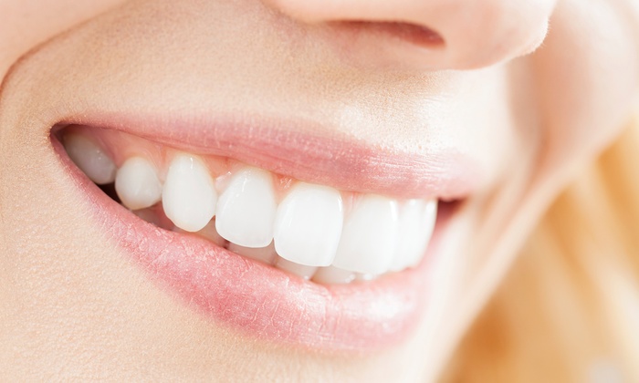 Perfect Straight Teeth – Without embarrassing metal braces?