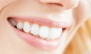 Close-up of a woman's smile showcasing straight white teeth