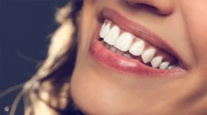 Close-up of a person smiling showing bright white teeth