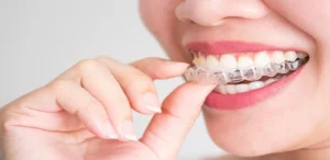 A close-up of a person smiling while inserting a clear dental aligner over their teeth