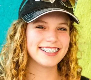 Smiling person showing braces