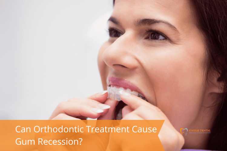 Orthodontic Treatment Cause Gum Recession