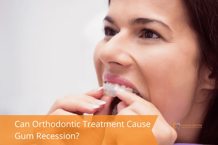 A woman inserts a clear orthodontic aligner into her mouth. The image includes text: "Can Orthodontic Treatment Cause Gum Recession?"