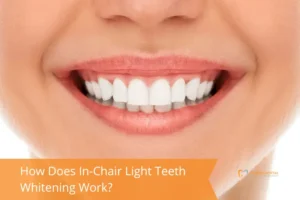 Close-up of a smiling person with bright white teeth. The image conveys a sense of dental health and confidence.