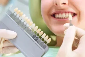 A dentist compares tooth color shades to a smiling patient's teeth using a shade guide. The scene is bright and conveys a sense of care and professionalism.