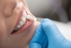 A dentist wearing blue gloves holds a dental shade guide next to a patient's smiling teeth, assessing for color match.