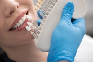 A dentist wearing blue gloves holds a tooth shade guide next to a smiling patient's teeth, matching shades for whitening or veneers.