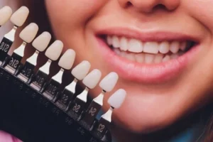 A person smiling with teeth shade guide in front, comparing tooth colors. The scene conveys dental care and cosmetic dentistry concepts