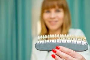 A dental shade guide being used to select a custom color for cosmetic veneers, showing how precision color-matching can address common aesthetic problems and provide a natural smile transformation.