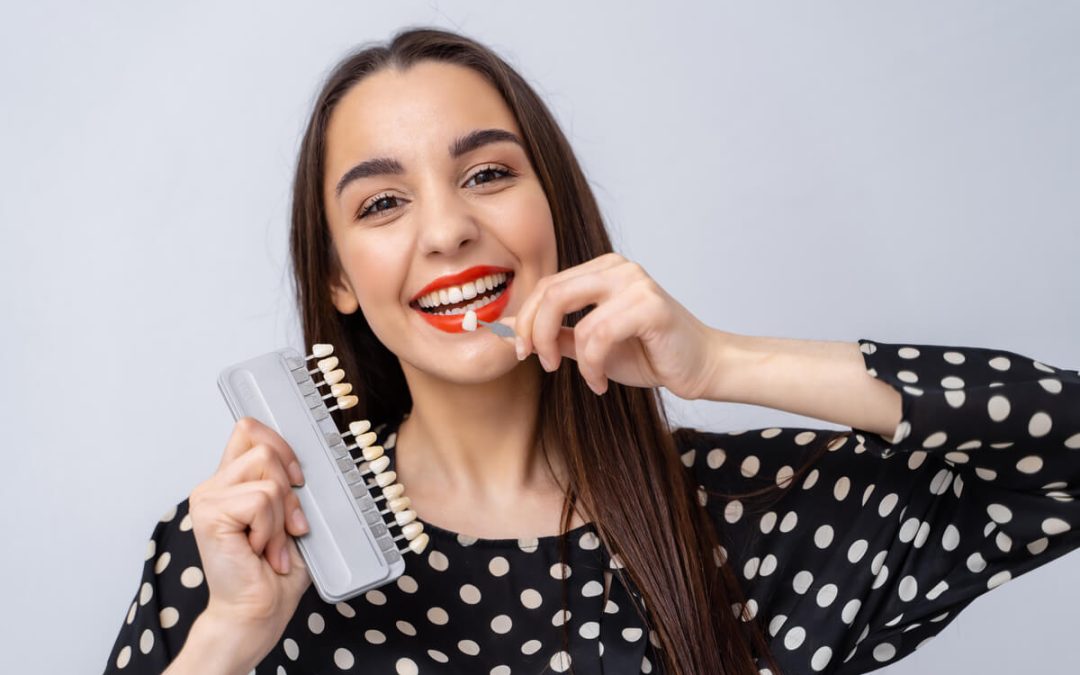 Teeth Prepared for Veneers — Professional Advice Tips For You