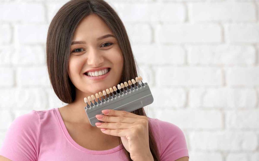 Veneers Teeth Pros And Cons — Discover What To Expect