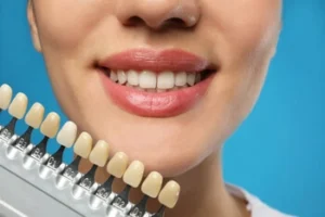 A close-up of a smiling person against a blue background, showing a dental shade guide next to their teeth, illustrating teeth whitening options.