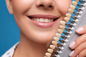 Smiling person holding a dental color matching chart.The chart shows various tooth shades for comparison