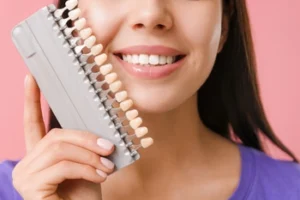 Smiling woman holding a dental shade guide near her mouth