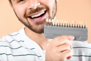 A smiling man with a beard holding a dental shade guide to his teeth, showcasing the personalized color-matching process used at Finesse Dental to achieve seamless, natural results.