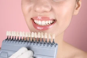 A smiling person holds a dental shade guide against their teeth, highlighting tooth color matching