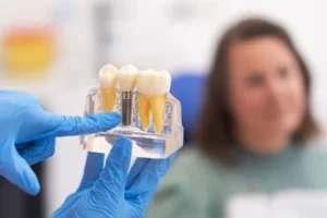 A person holds a dental model showing implants. An unfocused individual in the background suggests a dental consultation setting