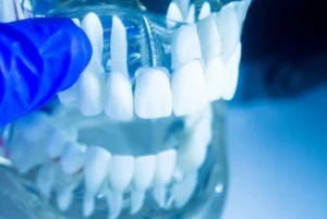 Close-up of a dental model showing white teeth in an open mouth position. A gloved hand holds the model against a bright, clinical blue background.