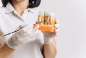 A dental professional in white gloves holds a tooth model, using a tool to point at the gums. The setting is clean, clinical, and educational.