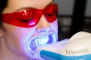 A person wears red protective glasses during a teeth whitening procedure, with a bright blue light illuminating their teeth
