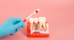 A gloved hand holds a toothbrush near a dental model displaying three teeth, one with roots exposed.