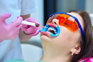 A professional dentist applying a hydrogen peroxide whitening gel to a female patient's teeth during a clinical teeth whitening procedure for a brighter smile