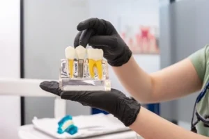 A person in black gloves holds a dental model displaying three teeth with visible roots. A dental office setting is subtly visible in the background
