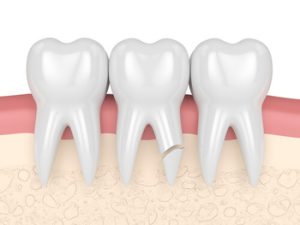 Nerve Pain In Tooth cause stanhope gardens