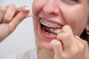 A person smiling uses dental floss on teeth with braces. The close-up focuses on oral hygiene techniques, highlighting the importance of dental care