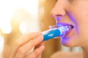 how long does teeth whitening last at home treatment A person using a blue LED teeth whitening device in their mouth