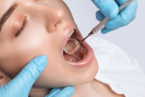 How Much Does a Root Canal Cost check