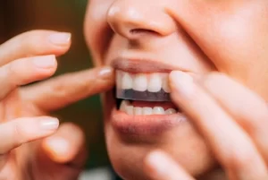 How to Whiten Teeth gels How to Whiten Teeth gels
