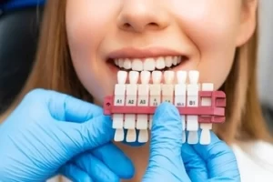 Teeth Whitening Aftercare check Teeth Whitening Aftercare check