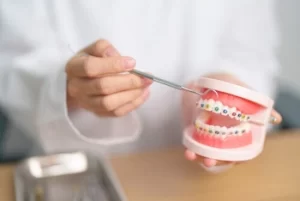 Dental Braces as orthodontic option on consultation Dental Braces as orthodontic option on consultation