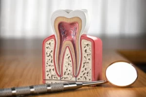 Tooth Extraction Pain Relief infection Tooth Extraction Pain Relief infection