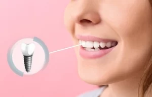 how to relieve pain from dental implant looks how to relieve pain from dental implant looks