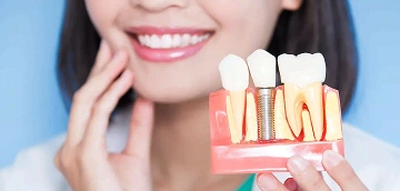 A woman smiles while holding a dental model showing a dental implant and natural teeth against a blue background, indicating oral health and dentistry.