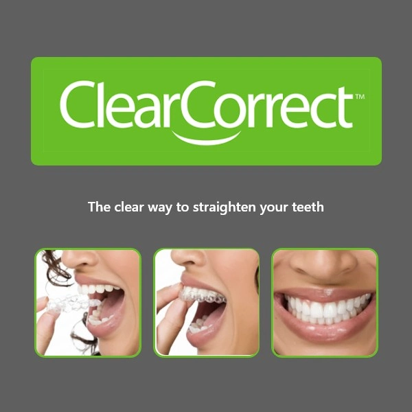 The Clear way to straighten your teeth." Below are three panels: inserting, adjusting, and smiling with aligners.