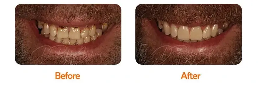 Finesse Dental Restorative Case 1