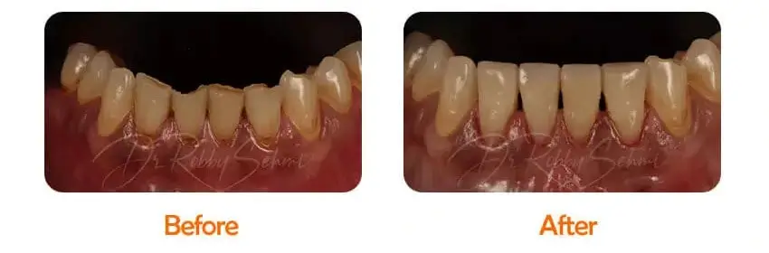 Finesse Dental Restorative Case 2