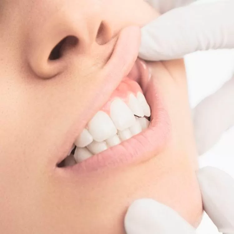 Close-up of a person’s mouth revealing teeth and gums