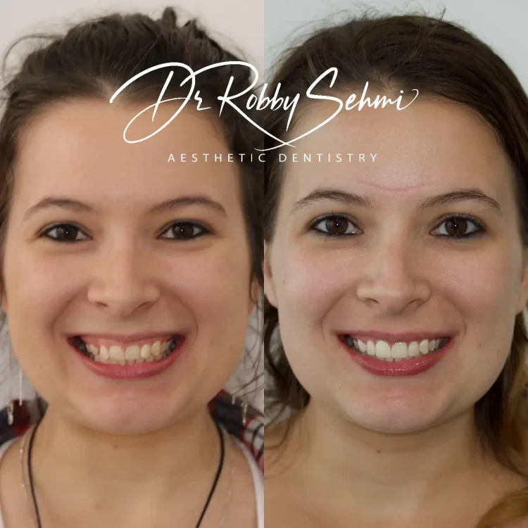 Amanda Allen before after