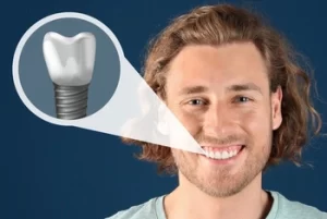 Bone Grafts For Dental Implants illustration Bone Grafts For Dental Implants illustration