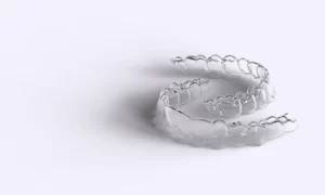 What Is Invisalign set What Is Invisalign set