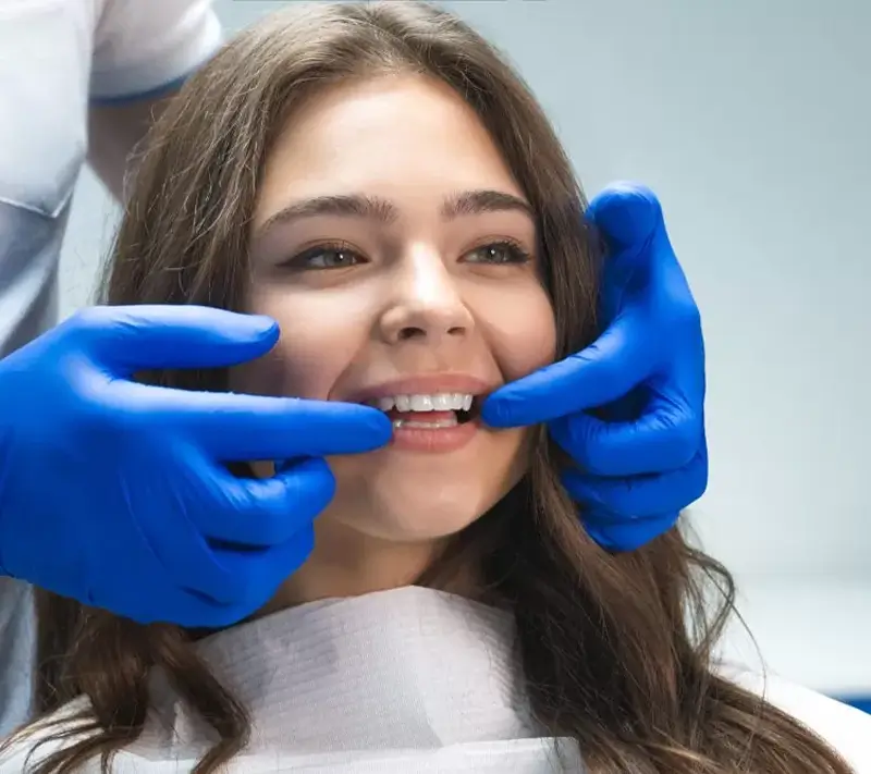 Porcelain Dental Veneers in Stanhope Gardens
