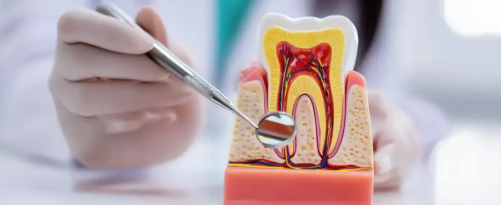 Root Canal Treatment in Stanhope Gardens