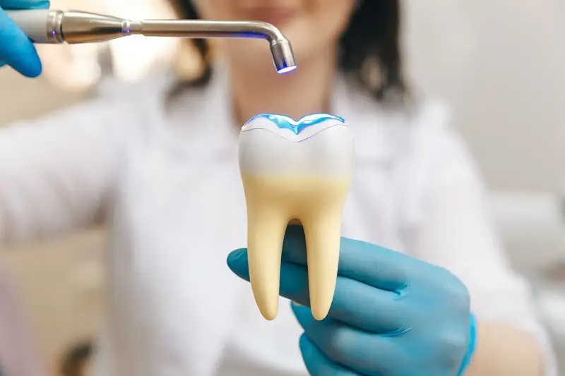 White Tooth Fillings in Stanhope Gardens